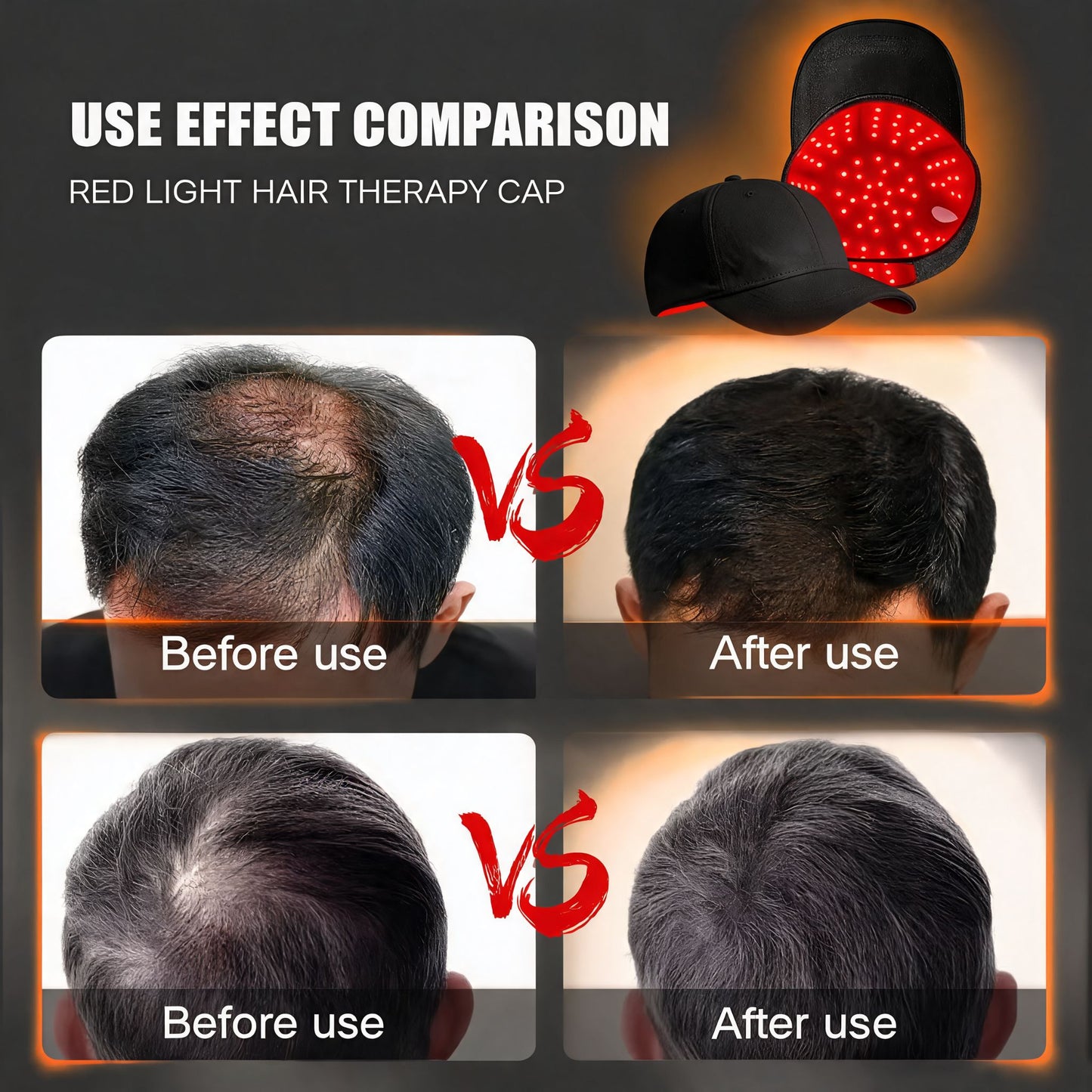NUROTECH Red Light Cap