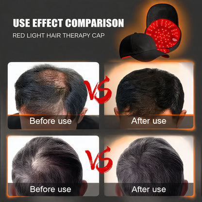 NUROTECH Red Light Cap